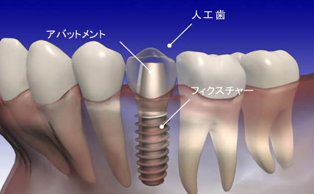 WEB業界の黒歴史　ヤラセ投稿